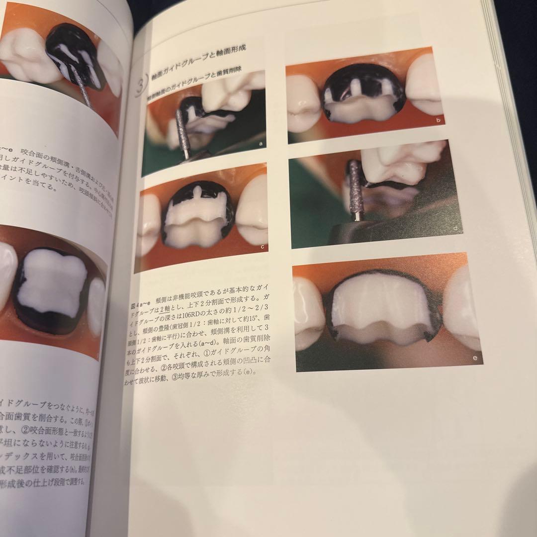 必ず上達 デジタル時代の歯冠修復　最終値下げ