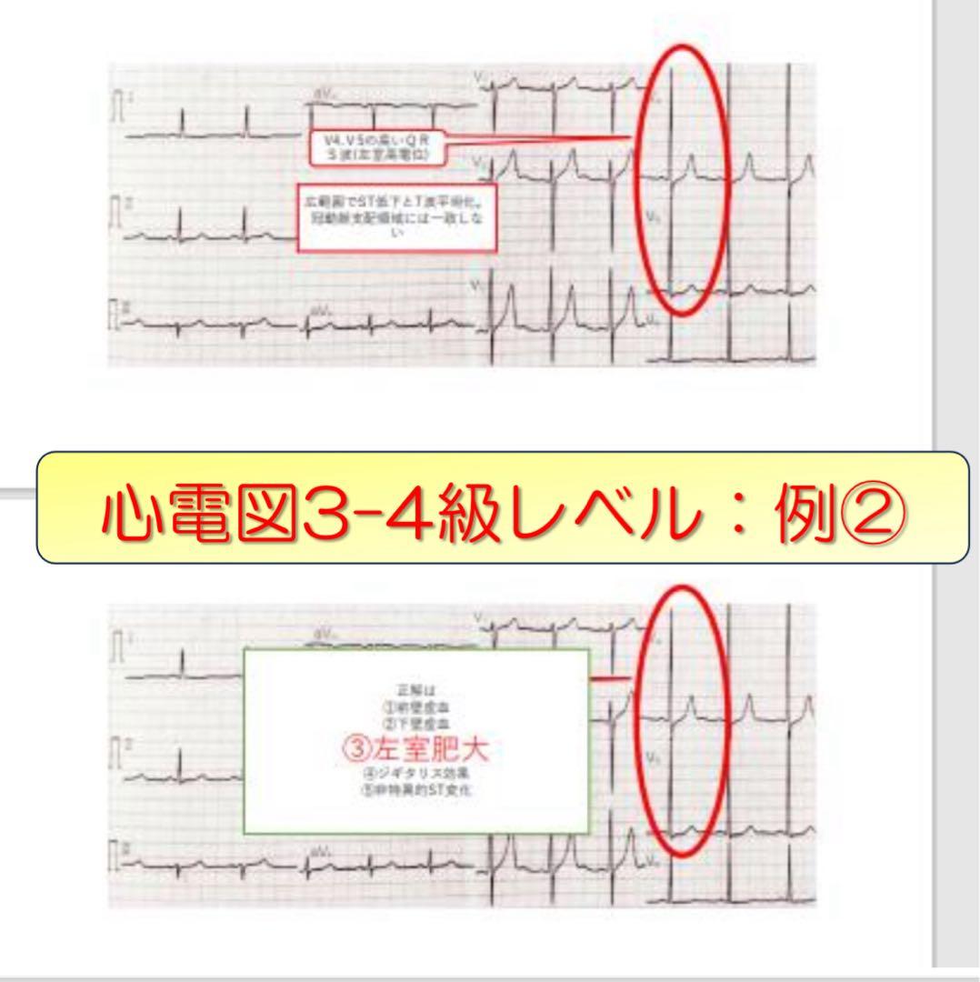 心電図検定対策7点セット
