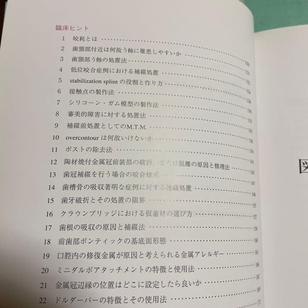 ❤️❤️❤️❤️補綴の診断と予後❤️❤️❤️❤️役に立つ臨床ヒントと反省