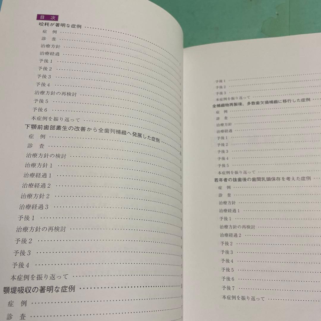 ❤️❤️❤️❤️補綴の診断と予後❤️❤️❤️❤️役に立つ臨床ヒントと反省