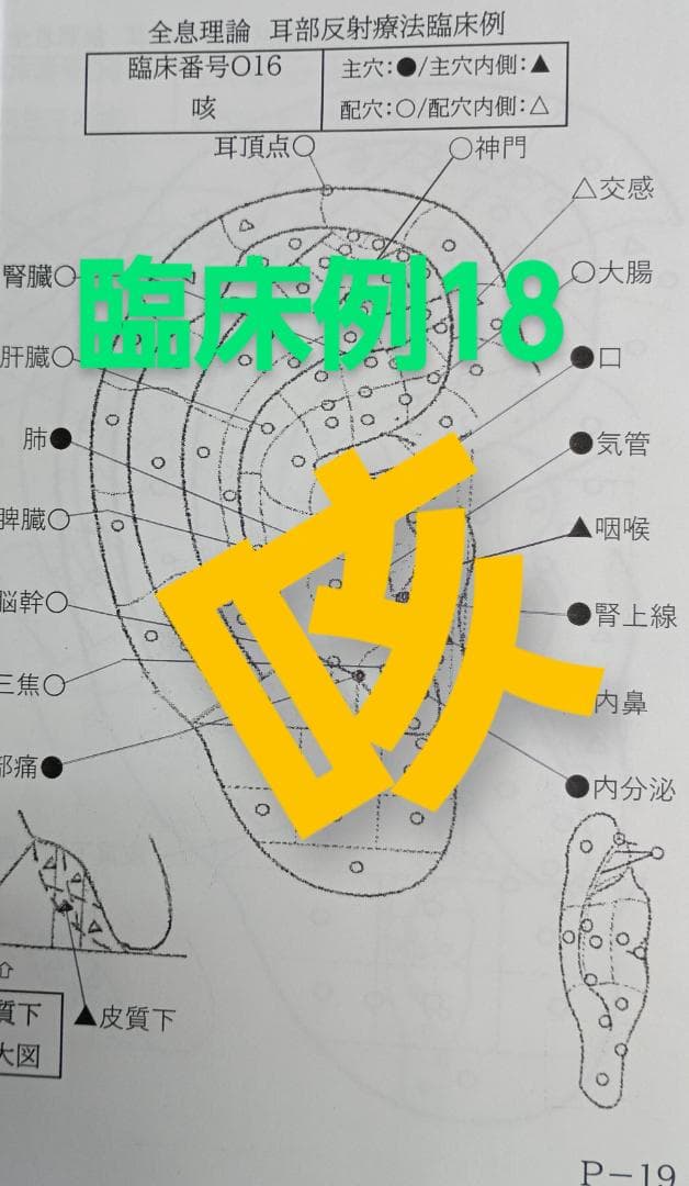 Bc:耳つぼ学ぶ：耳臨床54例集+臓器/躯体ラミネート+解説冊子/プリントset