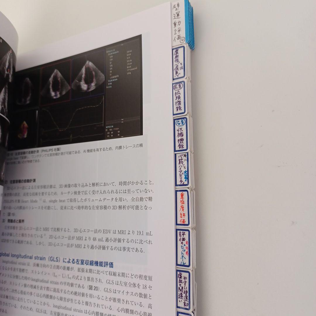 心臓超音波テキスト 第3版