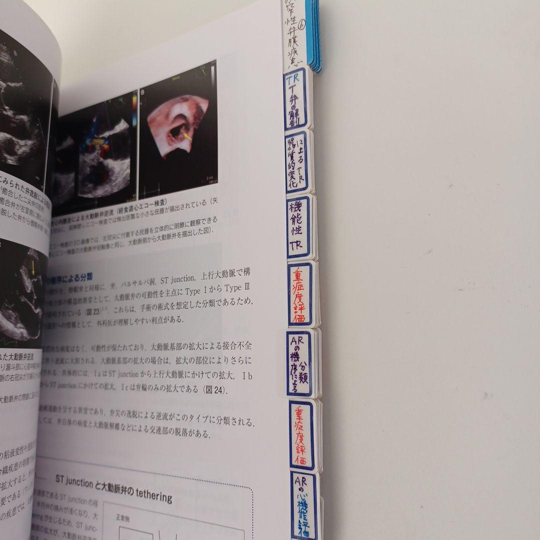 心臓超音波テキスト 第3版