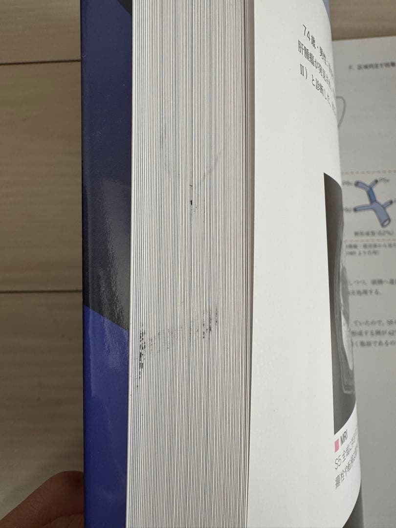 肝オペの美学 : 髙山式肝手術のすべて