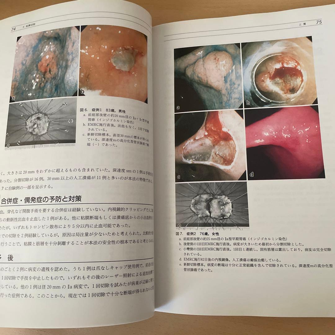 消化器治療内視鏡の基本手技