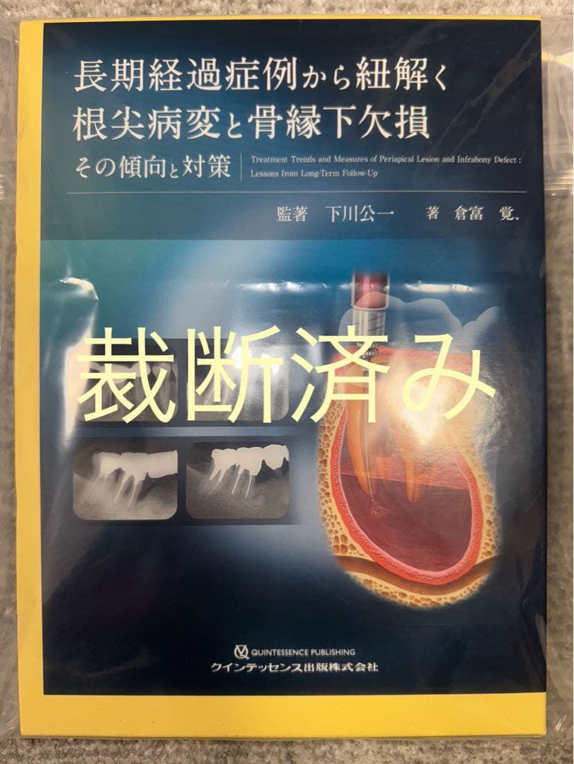 【裁断済み】長期経過症例から紐解く根尖病変と骨縁下欠損