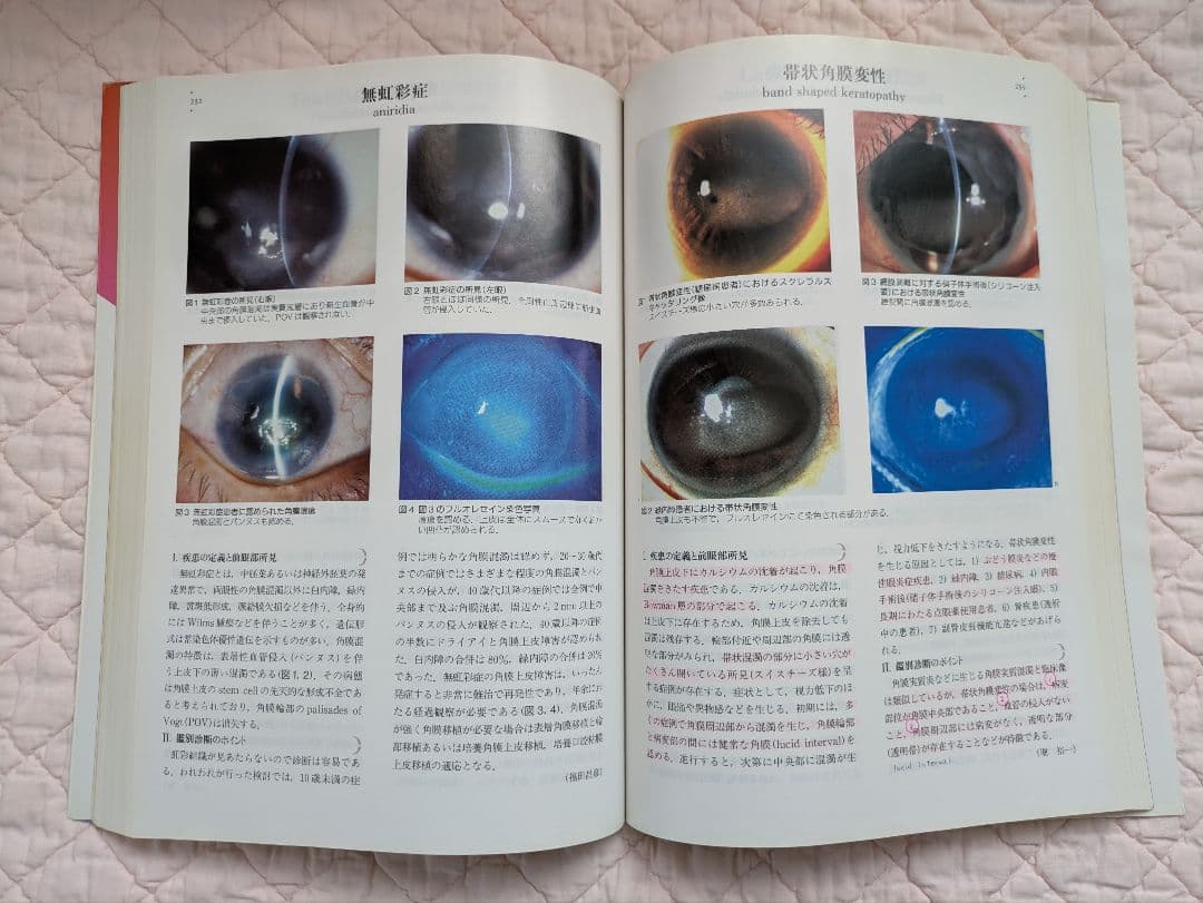 眼科プラクティス18 前眼部アトラス　文光堂