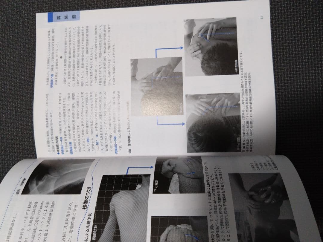 触診技術　整形外科ナビゲーション　上肢2冊セット　理学療法　新人　作業療法　PT