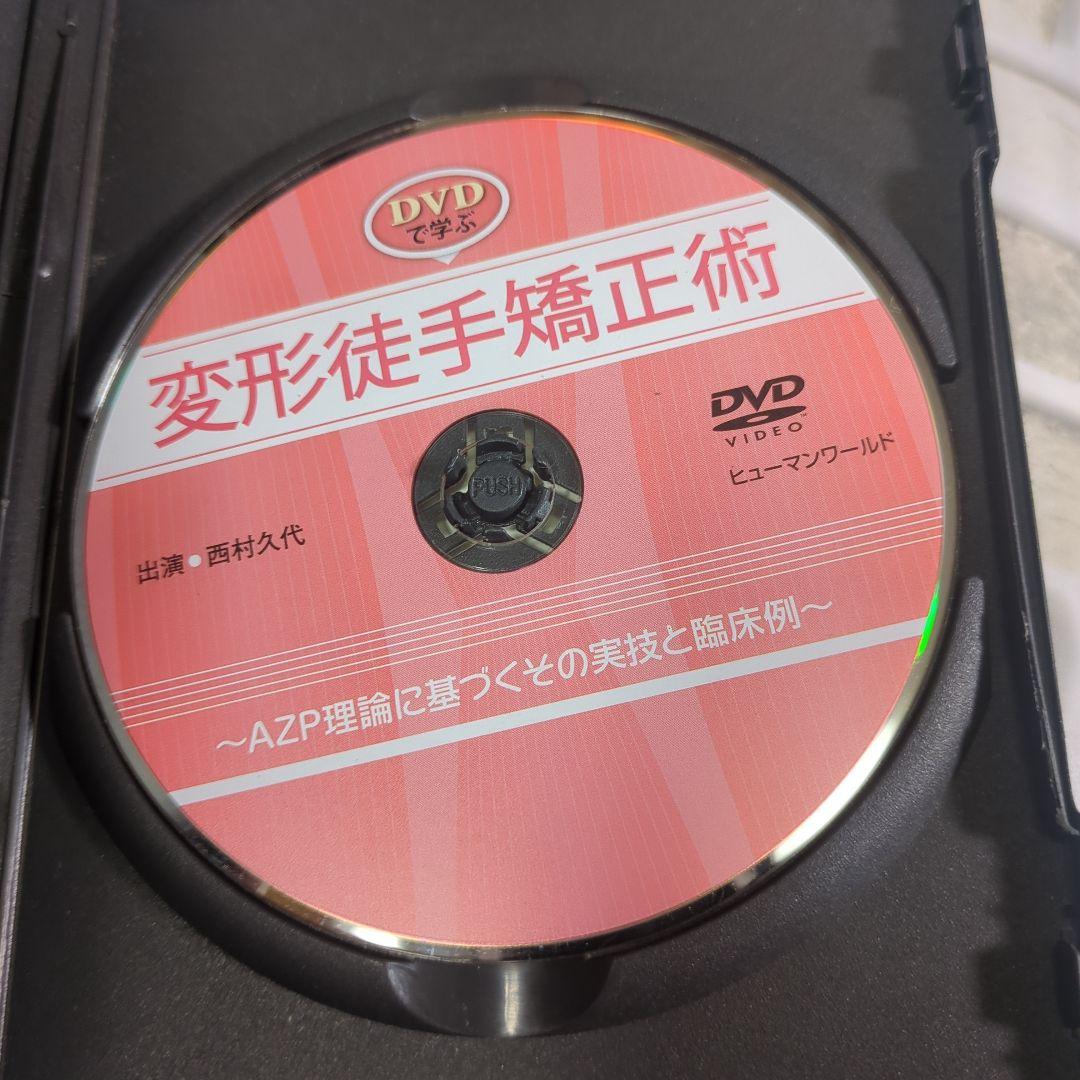 変形徒手矯正術 DVD