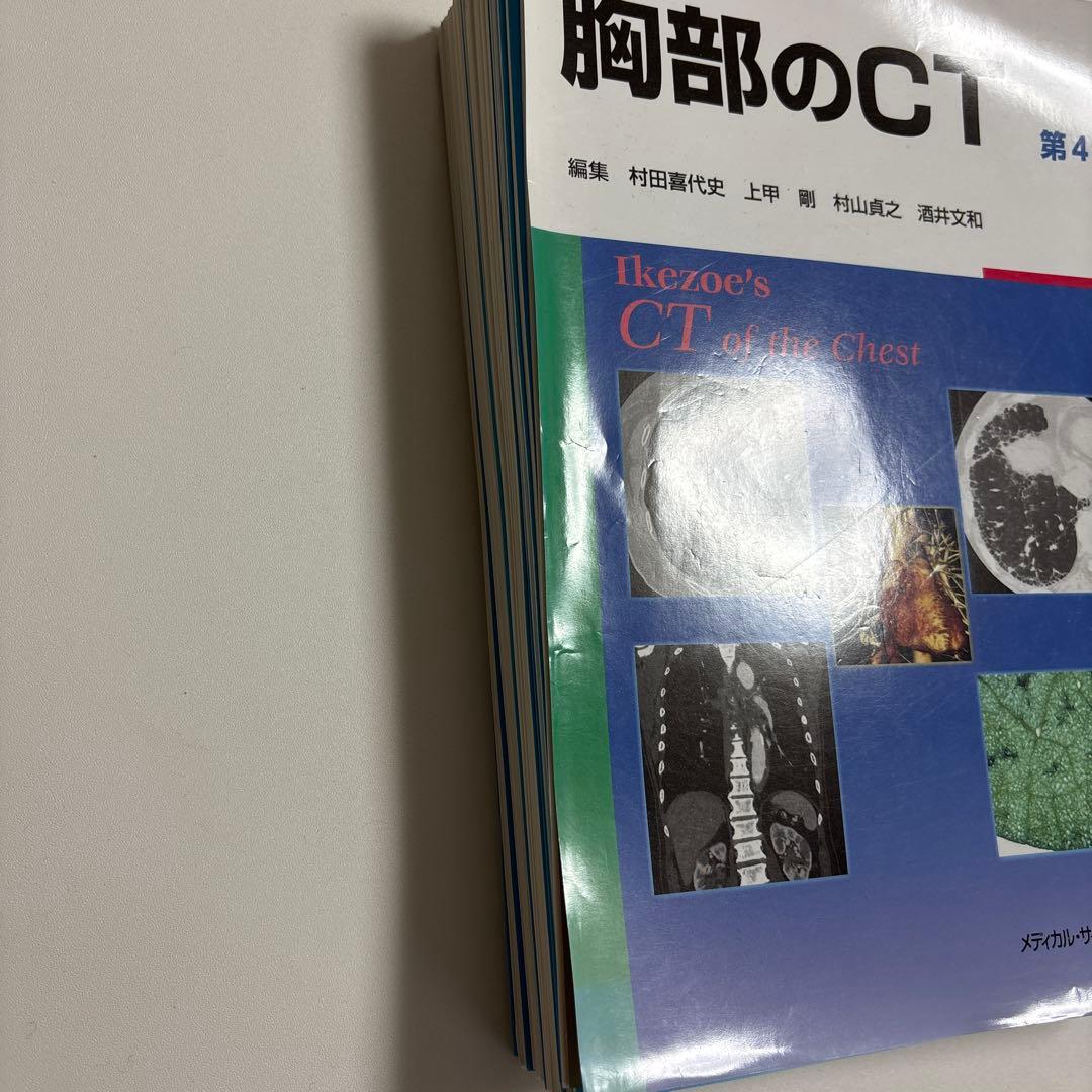 【裁断済み】胸部のCT