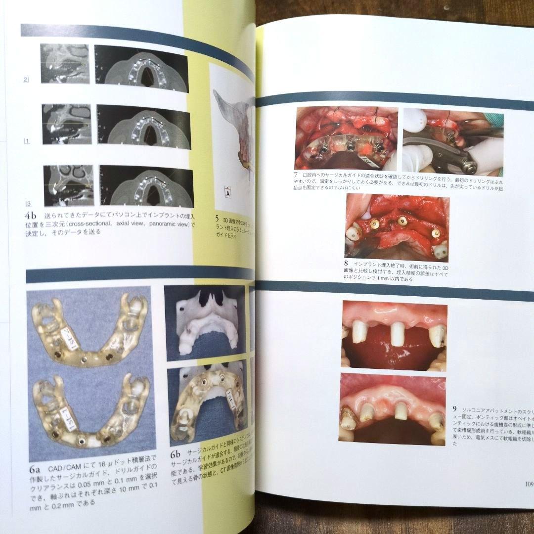 インプラントレストレーション vol. III