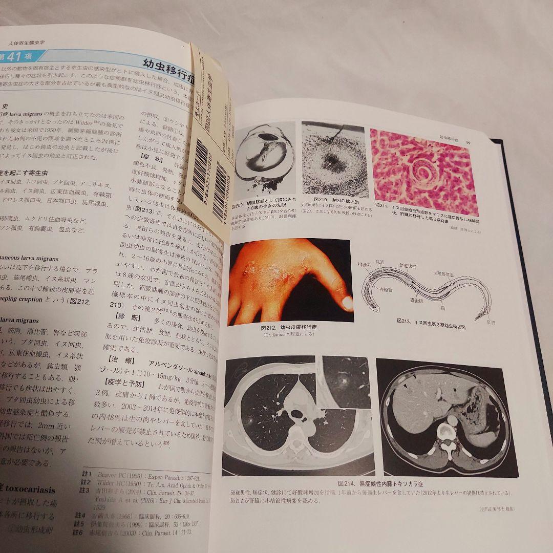 【美品　送料込み】　図説　人体寄生虫学　改訂10版　おすすめの医学書です
