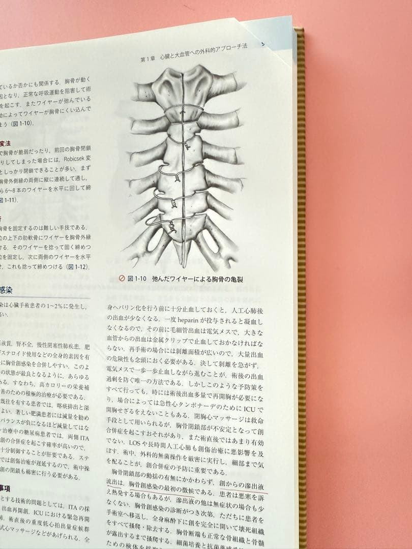 【発送時カバー無し】セーフティテクニック心臓手術アトラス