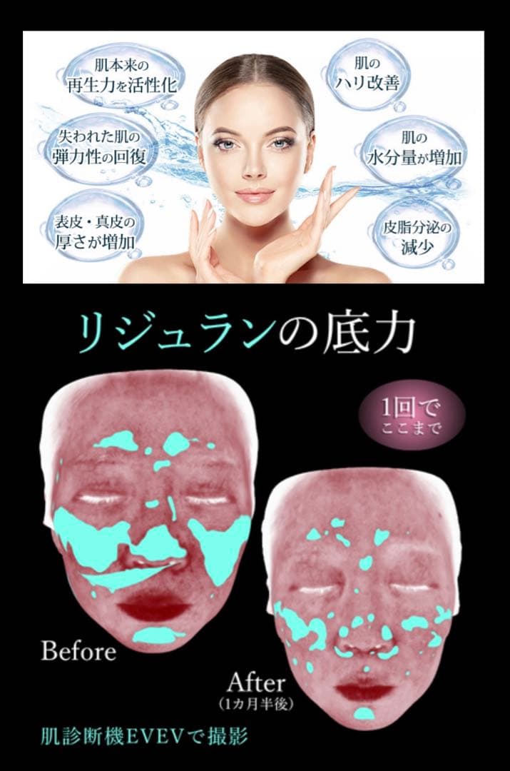 美しい魂の天使のお店　kokoro店　高純度リジュラン×２本