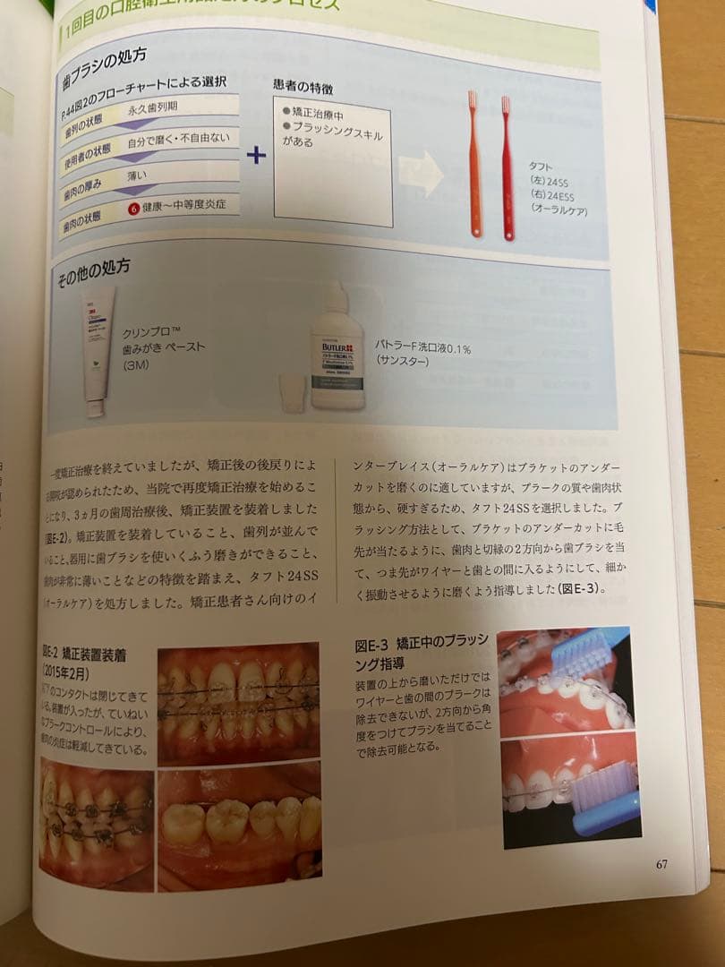 歯ブラシ処方箋