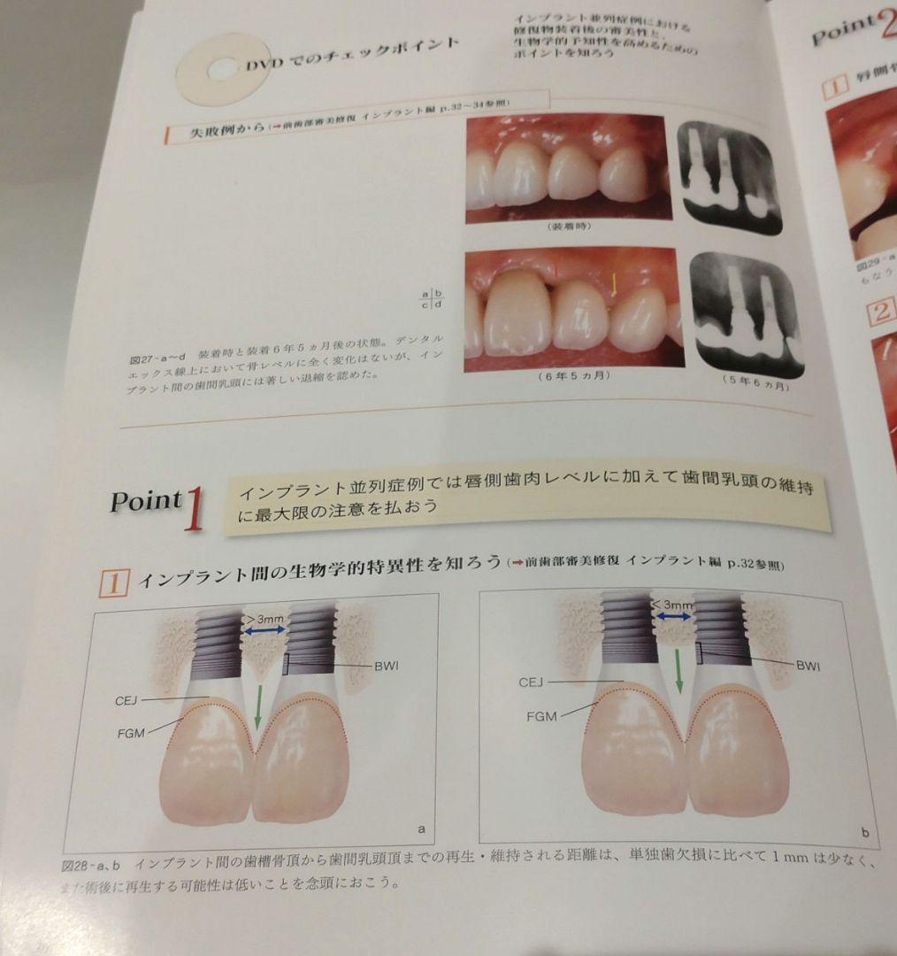 前歯部審美修復 チェアサイド・テクニック編 小濱忠一 歯科 治療 DVD 本