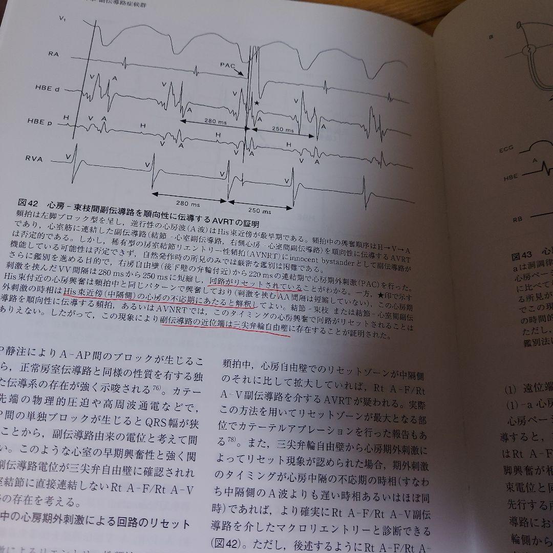 EPS : 臨床心臓電気生理検査　第2版