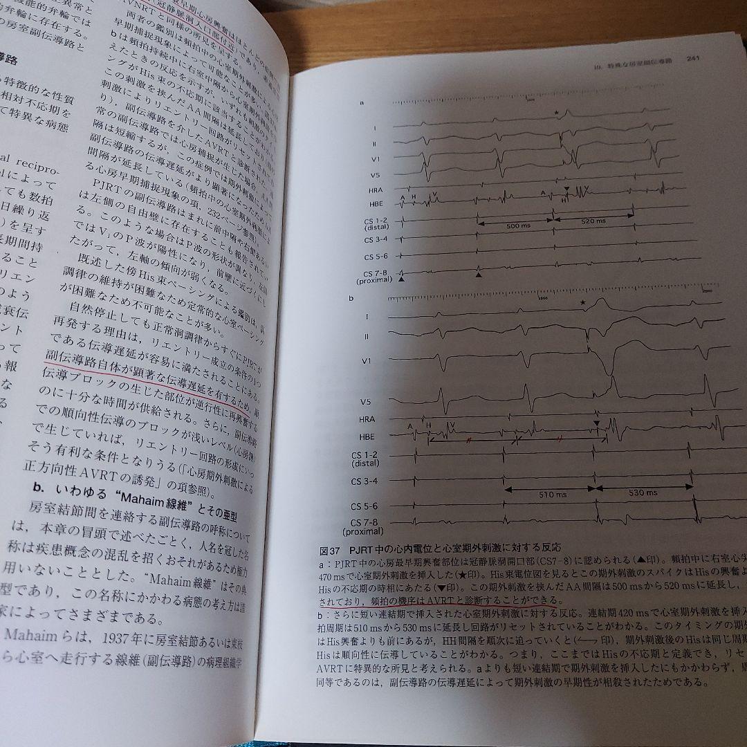 EPS : 臨床心臓電気生理検査　第2版